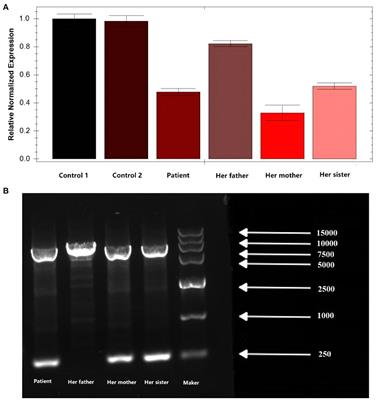 Case report: A novel 5'-UTR-exon1-intron1 deletion in MLYCD in an IVF child with malonyl coenzyme A decarboxylase deficiency and literature review